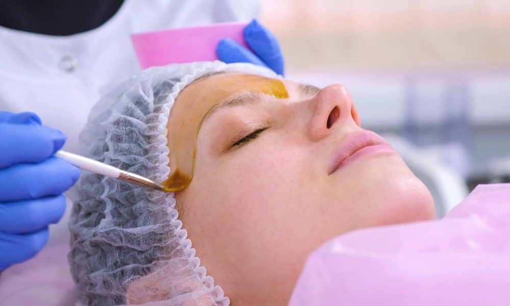 Which Is Better Chemical Peeling Or Laser Treatment?