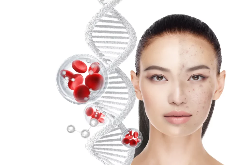 What Areas of the Face Can Be Treated with Sculptra