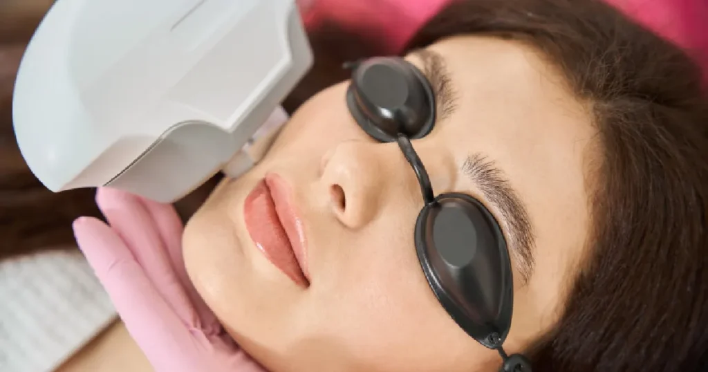 Women receiving IPL Photorejuvenation in Bonita Springs, FL