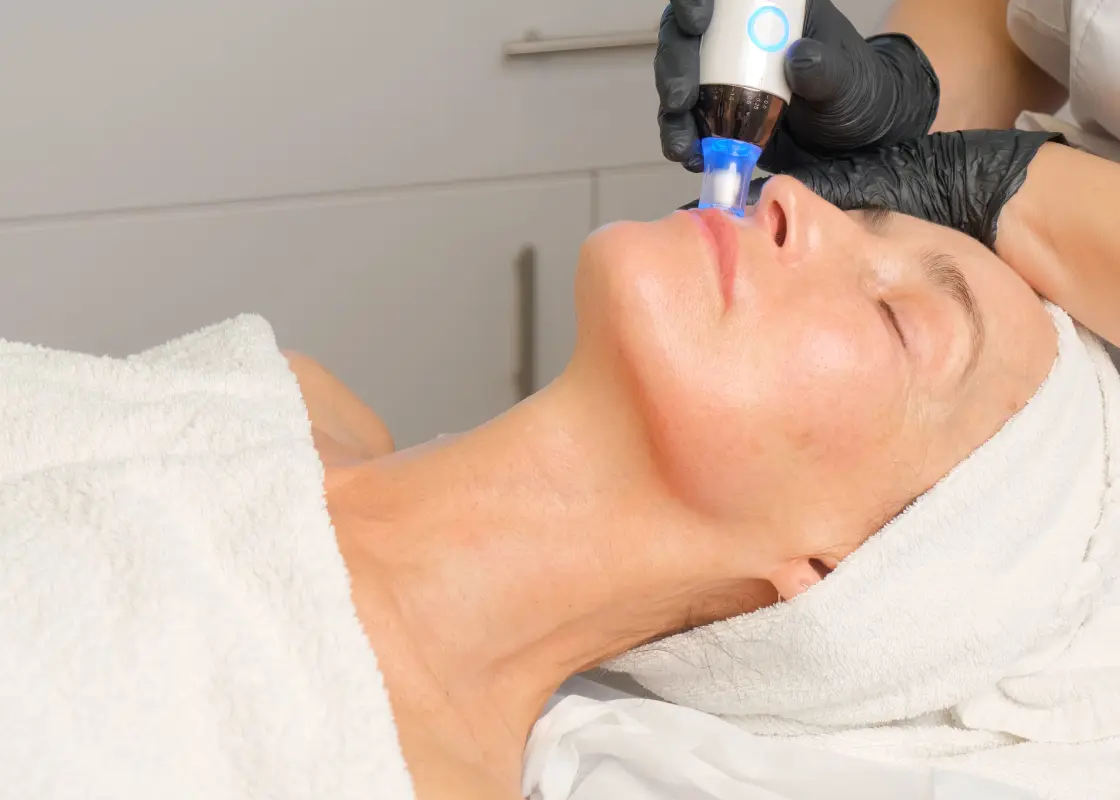 Benefits of Laser Skin Resurfacing for Smoother, Younger Skin